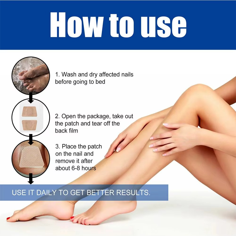 Fungus Repair Patches