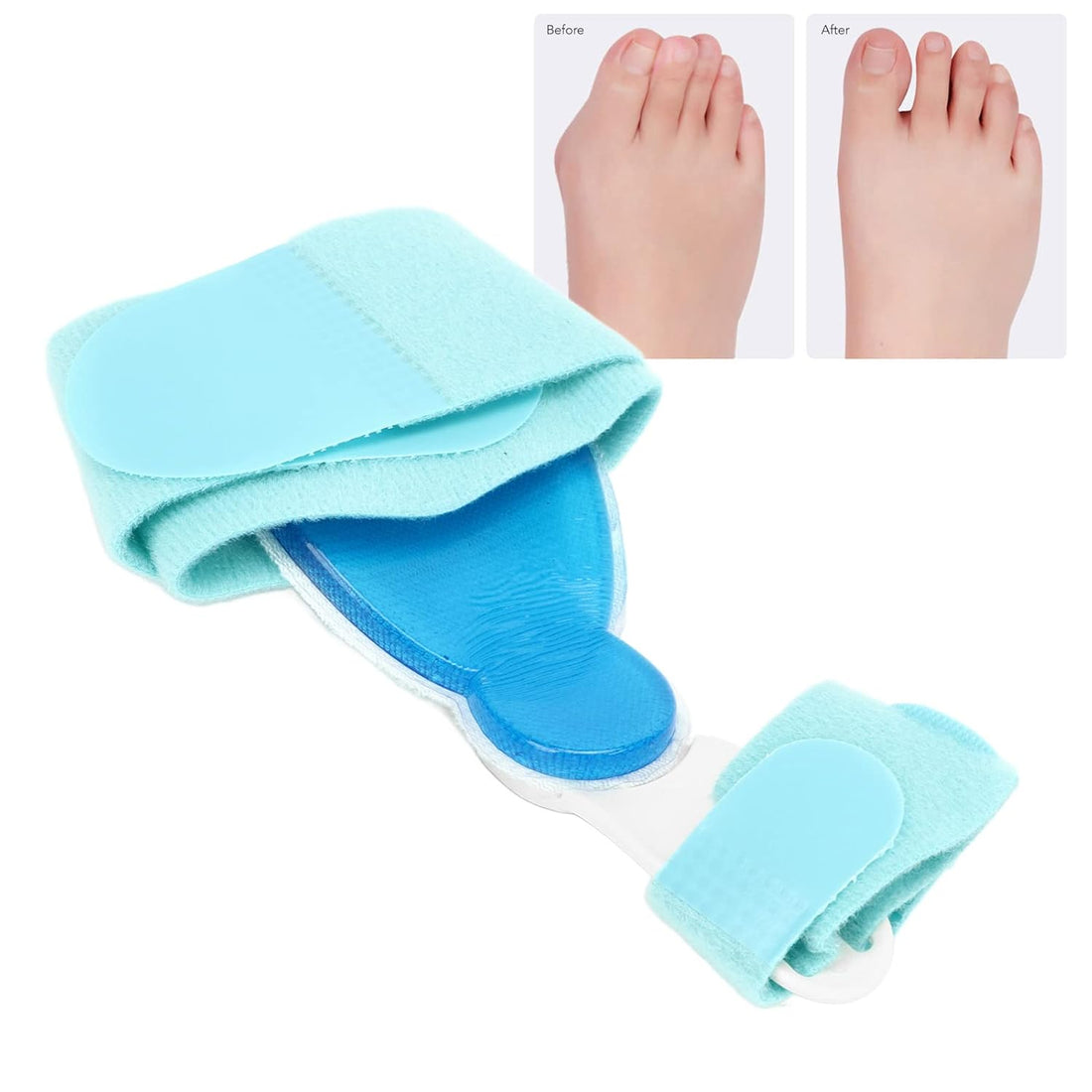Bunion Corrector Foot